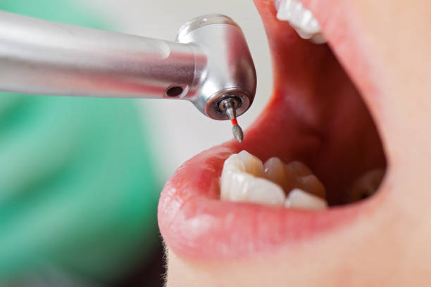 Best Emergency Gum Pain Relief  in Cameron, TX